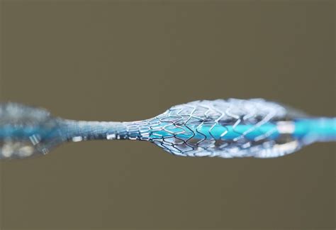  Nitinol: Voor Superelastische Legering en Medische Innovatie!